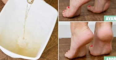Voici comment adoucir les pieds secs avec des astuces naturelles