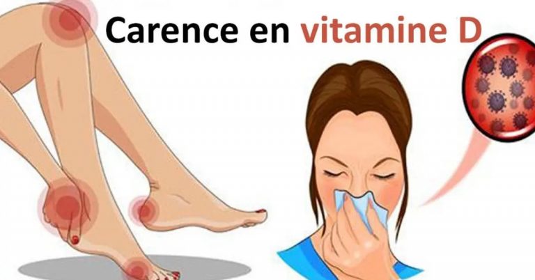 Le manque de vitamine D vous rend malade et fatigué 9 signes à identifier