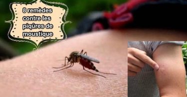 8 Remèdes Maison Contre les Piqûres de Moustiques Qui GRATTENT
