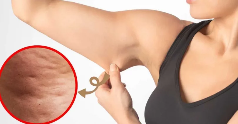 Combattez la cellulite de vos bras avec ces exercices pour les tonifier et les affiner
