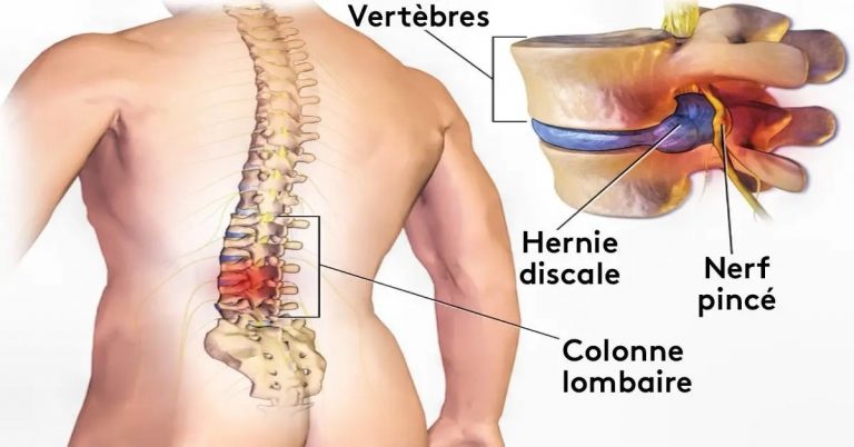 Apprenez à soulager vos douleurs du dos avec vos pieds : 9 exercices pour résoudre vos problèmes